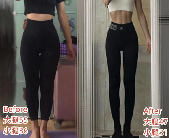 判断肌肉腿脂肪腿水肿腿_瘦小腿不同类型方法_瘦的人血脂高是什么原因