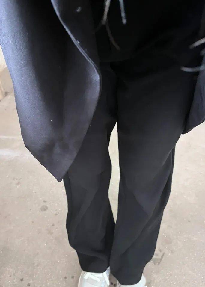 正常腿型是什么样子的_根据腿型选裤子_O型腿裤子推荐