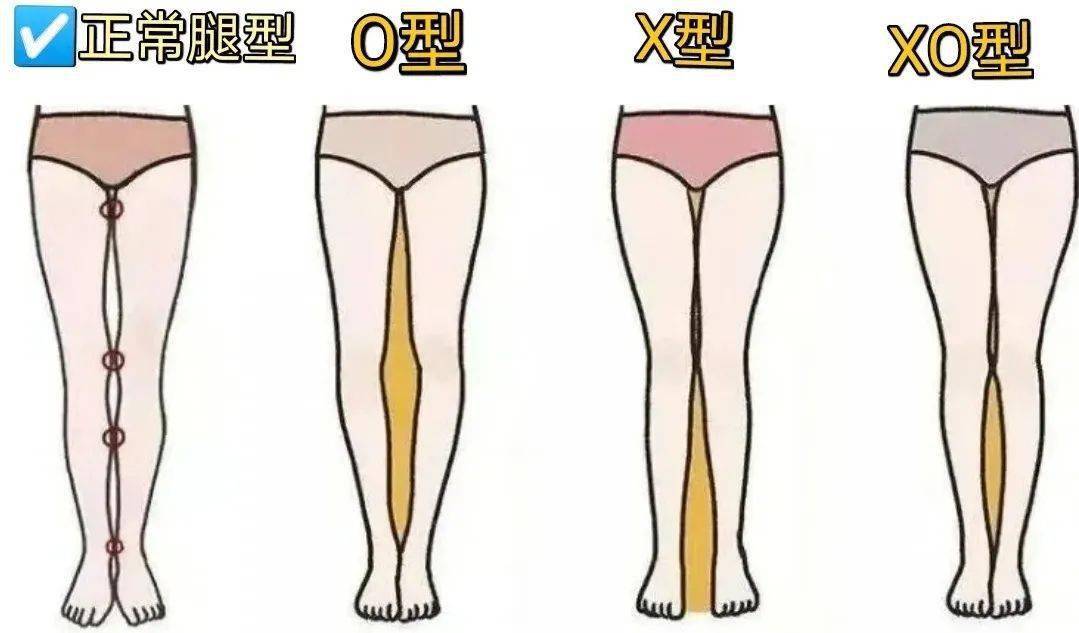 O型腿裤子推荐_根据腿型选裤子_正常腿型是什么样子的