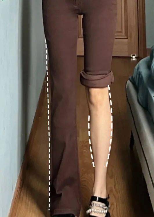 根据腿型选裤子_O型腿裤子推荐_正常腿型是什么样子的