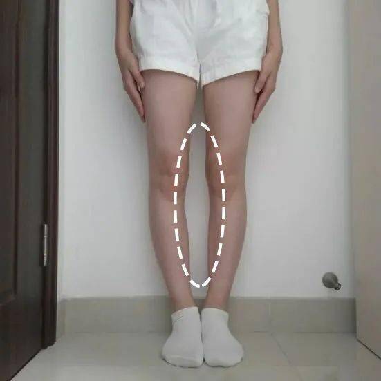 根据腿型选裤子_O型腿裤子推荐_正常腿型是什么样子的