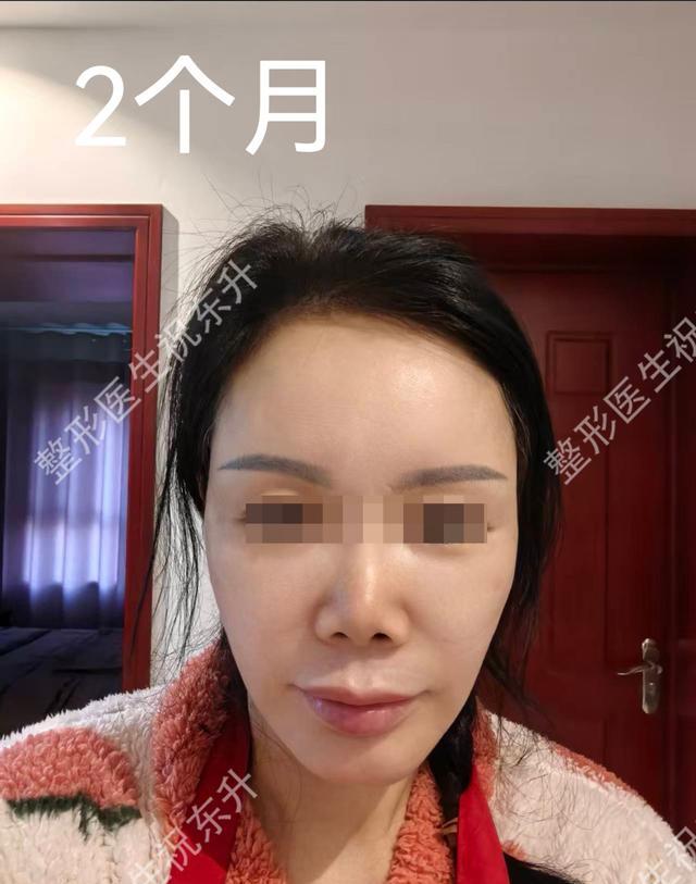 退休金医美消费趋势分析_电波拉皮除皱做几次能除皱_50+医美面部提升手术安全正规医院