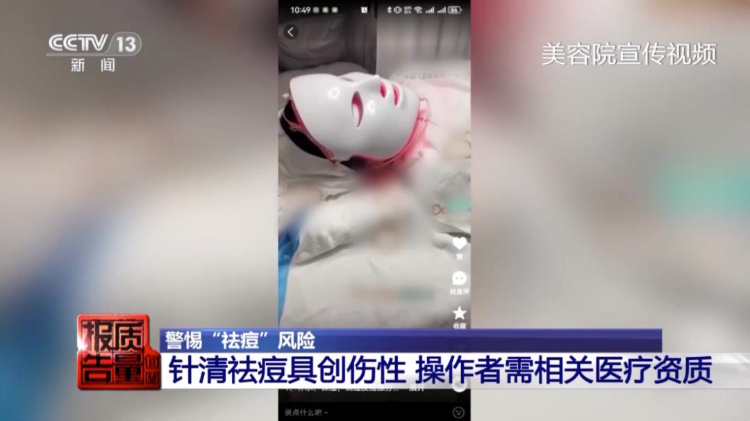 美容院做脸部护理好吗_针清祛痘危害_美容院祛痘