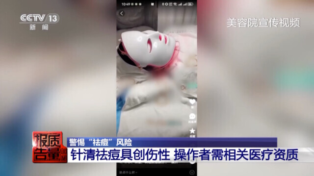 美容院做脸部护理好吗_美容院祛痘_针清祛痘危害